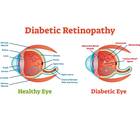A New Ally in the Diagnosis and Management of Diabetic Retinopathy