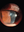 Figure 5. Slit-lamp photo of the patient’s cornea post hydrops.