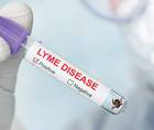 Screening for Biomarkers of Lyme Related Infection