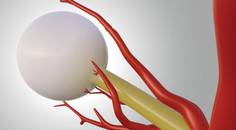 The Mystery of Cilioretinal Arteries and AMD