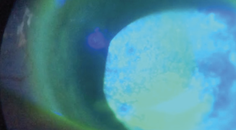 When 20Happy Falls Short