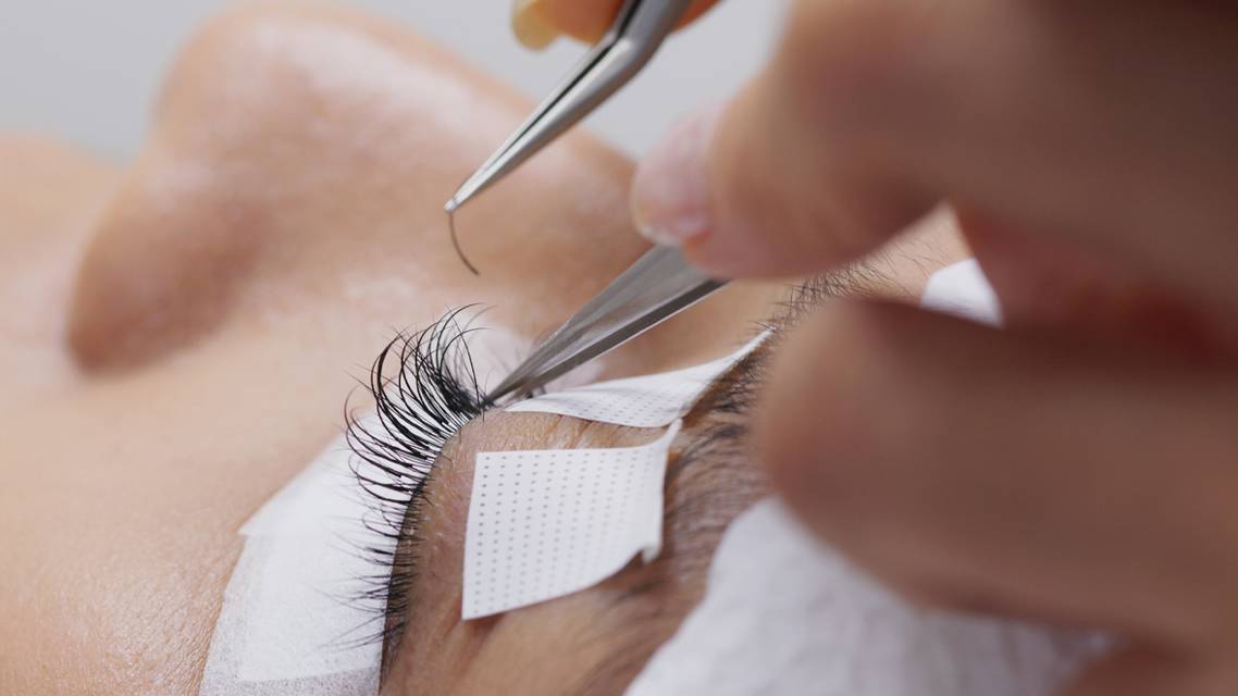 Managing Demodex Blepharitis in Eyelash Extension Wearers
