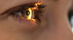 A Two Pronged Approach to Keratoconus Management