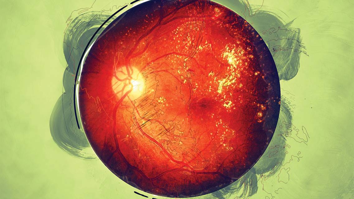 Dealing With Diabetes