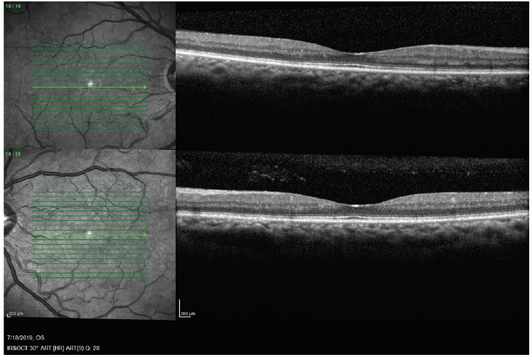 The Importance of Collaborative Care for Patients With Diabetic Retinopathy
