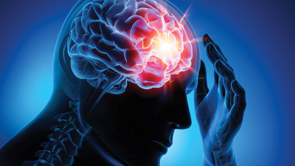 Managing Patients With Concussion