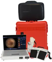 NeoLight’s Icon Go With Fluorescein Angiography Capabilities Cleared by FDA for Portable Retinal Imaging image