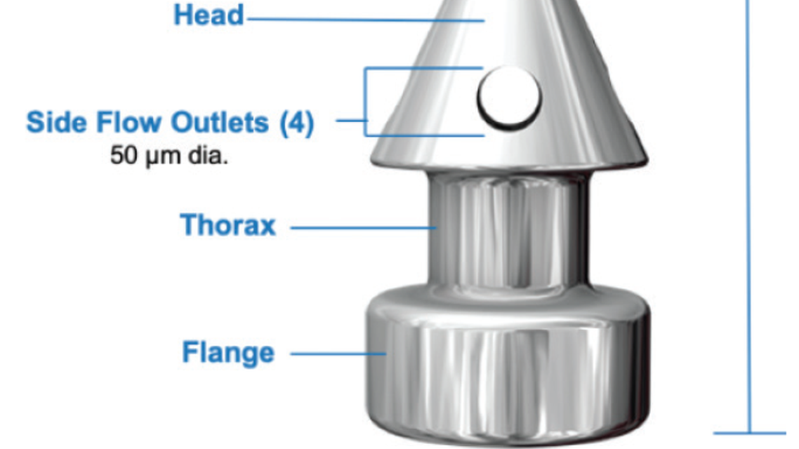 A Collaborative Approach to iStent Inject Implementation