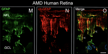 Bunkers That Save Sight? UConn Researchers Take a Close Look image