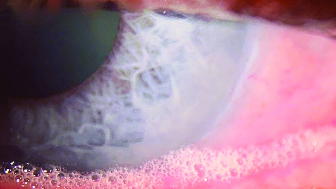 Saponification