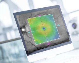 Zeiss Receives CE Mark for Cirrus PathFinder AI Tool with Automated OCT Assessment image