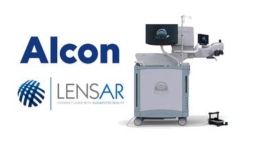 Alcon Boosts Femtosecond Laser Technology with Acquisition of Lensar image