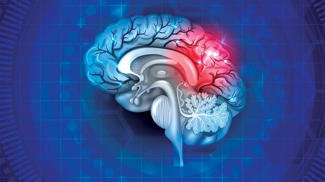 Medical Coding for Stroke and Concussion Care