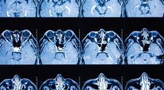 Rare But Not Impossible