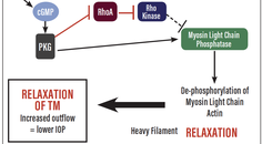 Current and Future Glaucoma Management An Update on Existing Options and the Therapeutic Pipeline