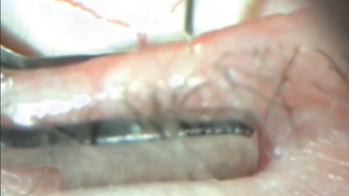 Tools and Techniques for Managing MGD