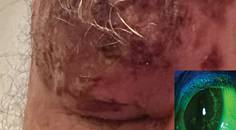 A New Standard in Managing HZO