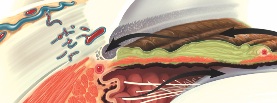 2024 Glaucoma Pipeline