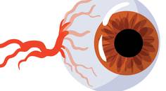 TRPn Out OSD Inflammation and Nerves