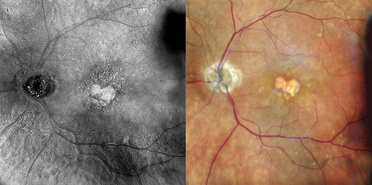 Nidek Announces the Winners of the 3rd Annual Images of the Year Award image