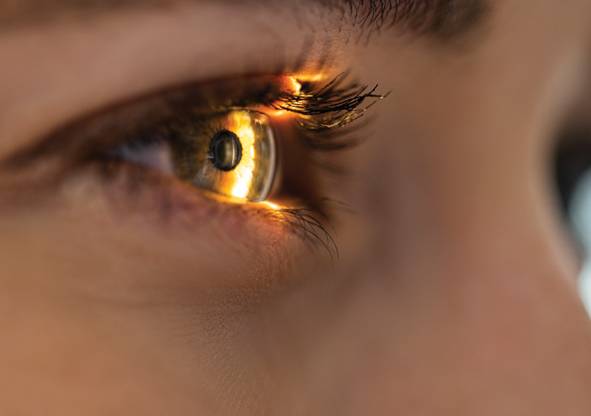 A Two Pronged Approach to Keratoconus Management
