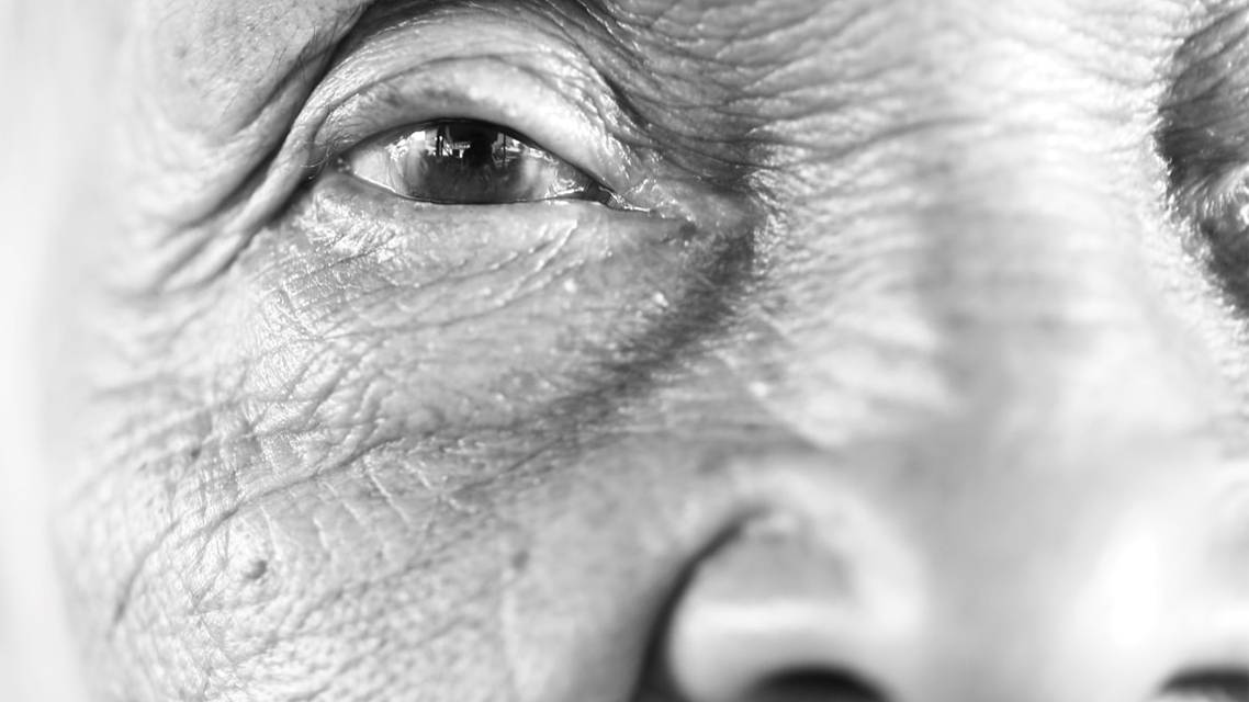 At Nerves End Neurotrophic Keratitis in a Monocular Patient