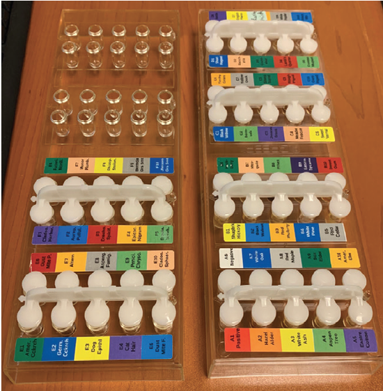 The Role of Allergy Testing in Eye Care