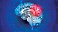 Medical Coding for Stroke and Concussion Care