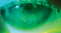 All About That Blink