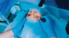 refractive surgery