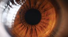 Scleral Lenses for Post Corneal Transplant