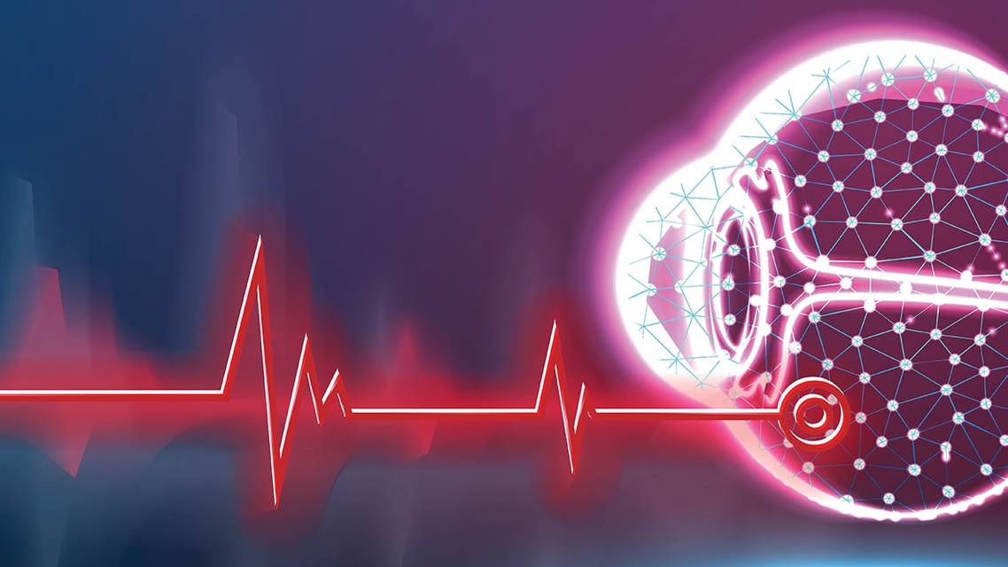 Radiation Induced Optic Neuropathy After Choroidal Metastasis