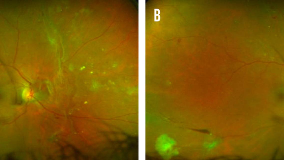 Why Its Important to Establish Effective Communication Among the Diabetic Patients Care Team