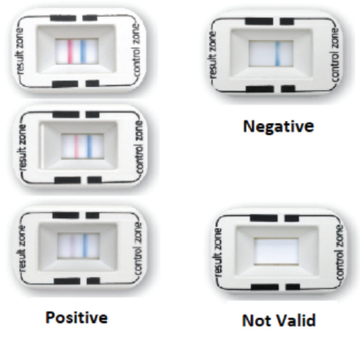 Osdd Test Essentials for Diagnosing OSD
