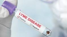 Screening for Biomarkers of Lyme Related Infection