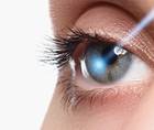 The Changing Role of Laser in Glaucoma