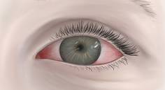 Is It Sjögren Syndrome or Something Else