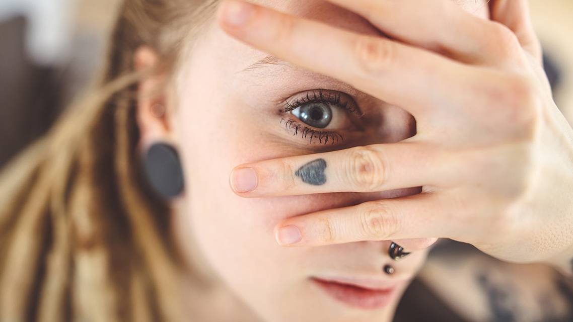 A Clinical Case of Tattoo Associated Uveitis