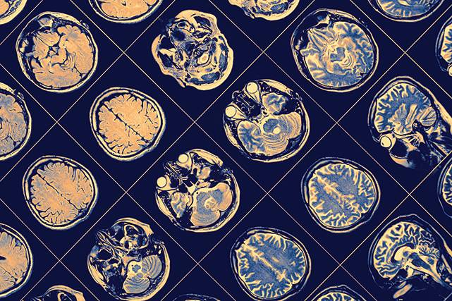 Neuro An Emerging Subset of Optometry