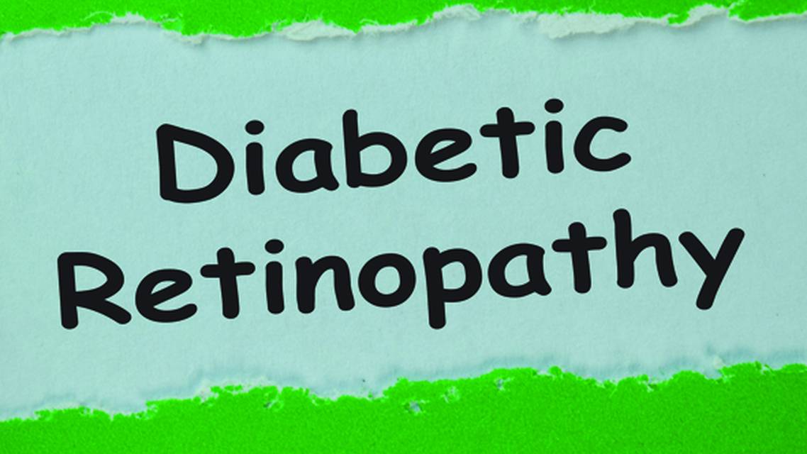 A Guideline for Managing Patients With DR