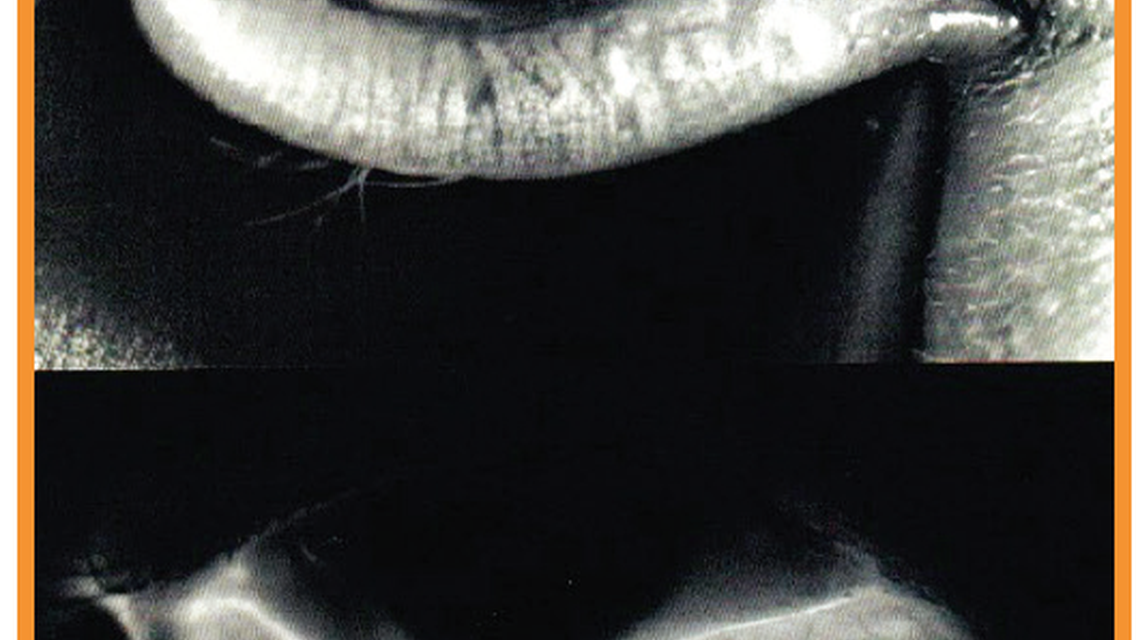 Evolving Concepts in Anterior Segment Outcomes Tackling Ocular Surface Disease Comanaging Premium IOL Patients and Identif