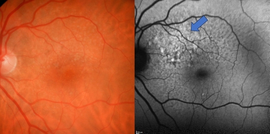Clinical Case Compendium: A Journey Through Detection, Tr