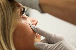 OHSU Researchers Discover Link Between Proteins in Tears, Pain After Eye Surgery image