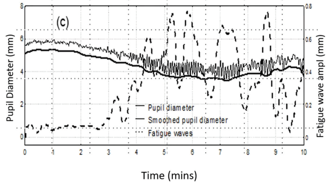 Supra Threshold Testing Is It Time to Rethink Perimetry