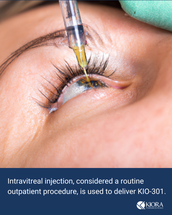 Kiora: Investigational Drug KIO-301 Has Potential to Restore Light Perception in Patients with Retinitis Pigmentosa image