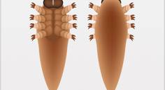 Long Awaited Treatment for Demodex Blepharitis Receives FDA Approval