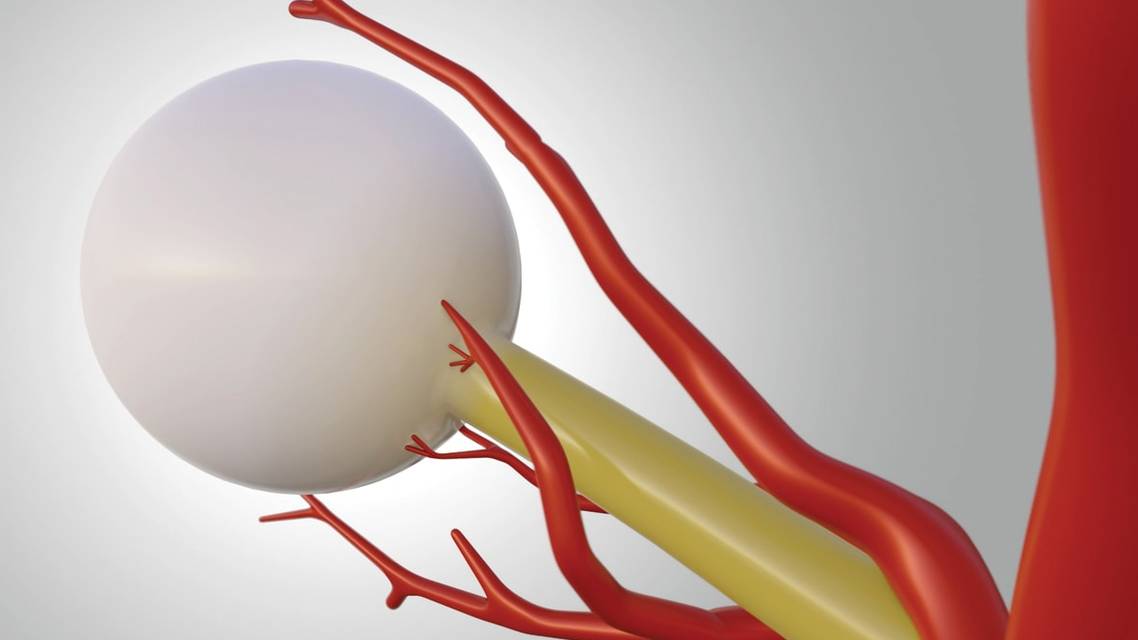 The Mystery of Cilioretinal Arteries and AMD