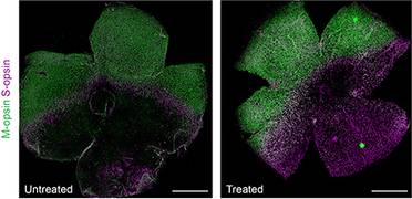 Study Lays Foundation for Establishing Base Editing as a One-Time, Durable Treatment for Inherited Retinal Degeneration image