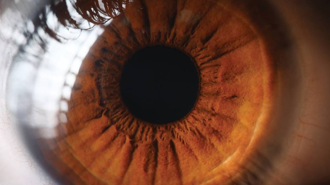 Scleral Lenses for Post Corneal Transplant