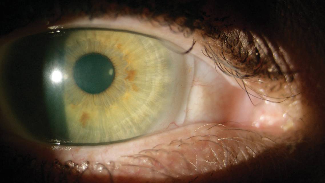 Diagnostics for the Right Fit